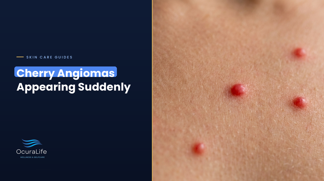 Multiple Cherry Angiomas Appearing Suddenly: When to Worry