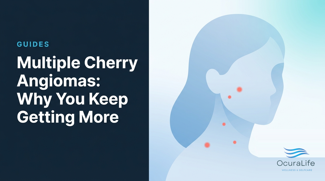 Multiple Cherry Angiomas: Why You Keep Getting More - OcuraLife