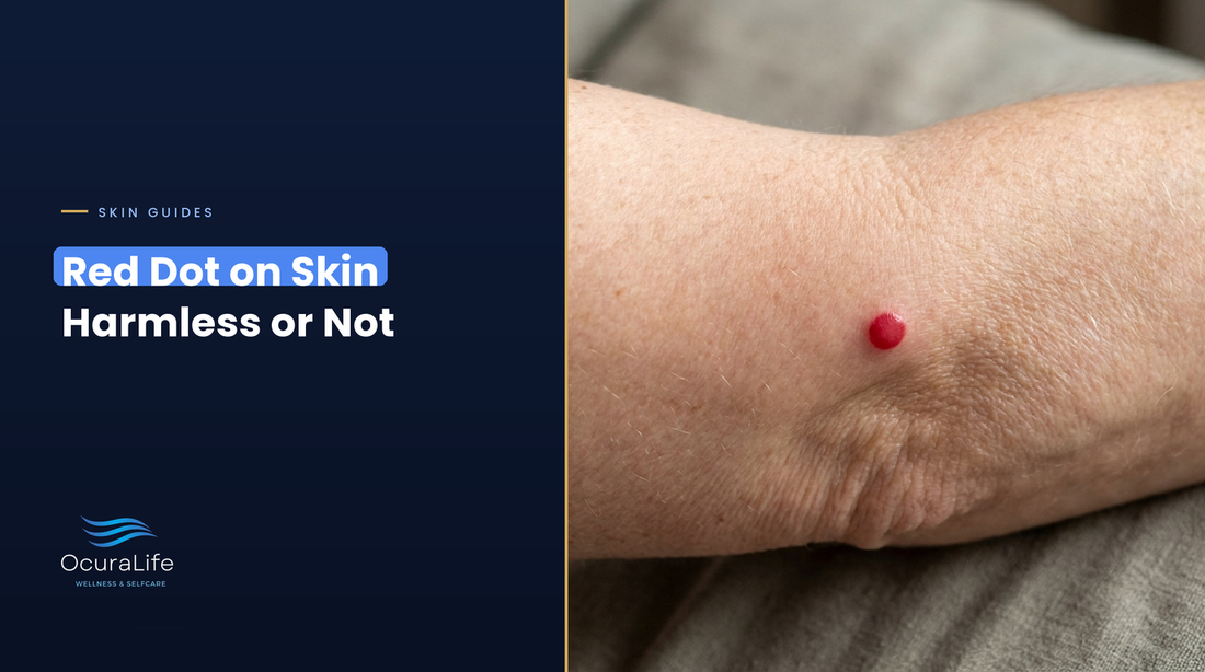 A small bright cherry-red dot on the arm of a woman in her late 40s, the typical look of a harmless cherry angioma