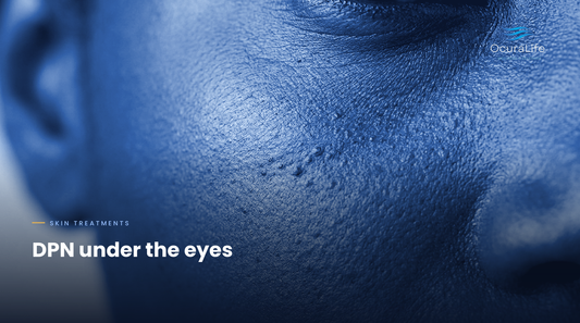 The Best At-Home Way to Treat DPN Under the Eyes