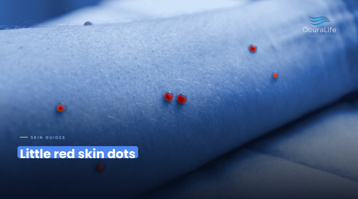 Tiny Red Dots on Your Skin? What a Dermatologist Says They Usually Are