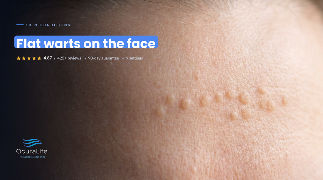 Flat Warts on the Face: Removal Options That Won't Scar