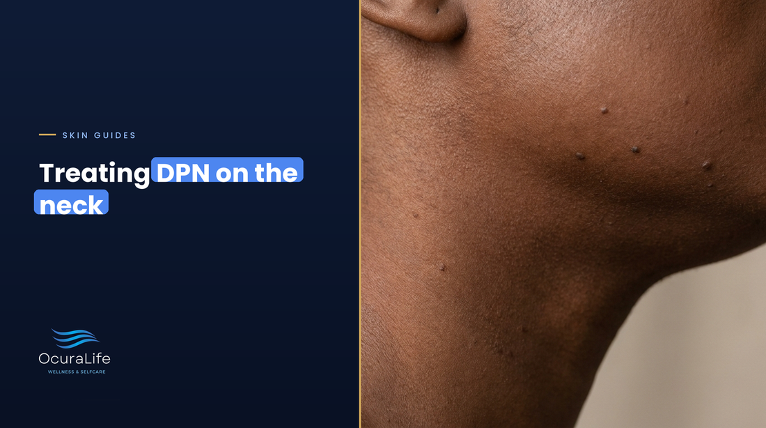 The Best At-Home Way to Treat DPN on the Neck