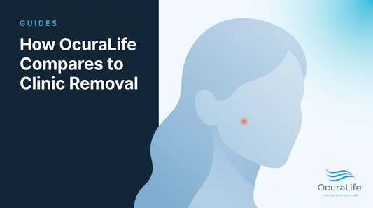 ocuralife-vs-clinic OcuraLife blog hero