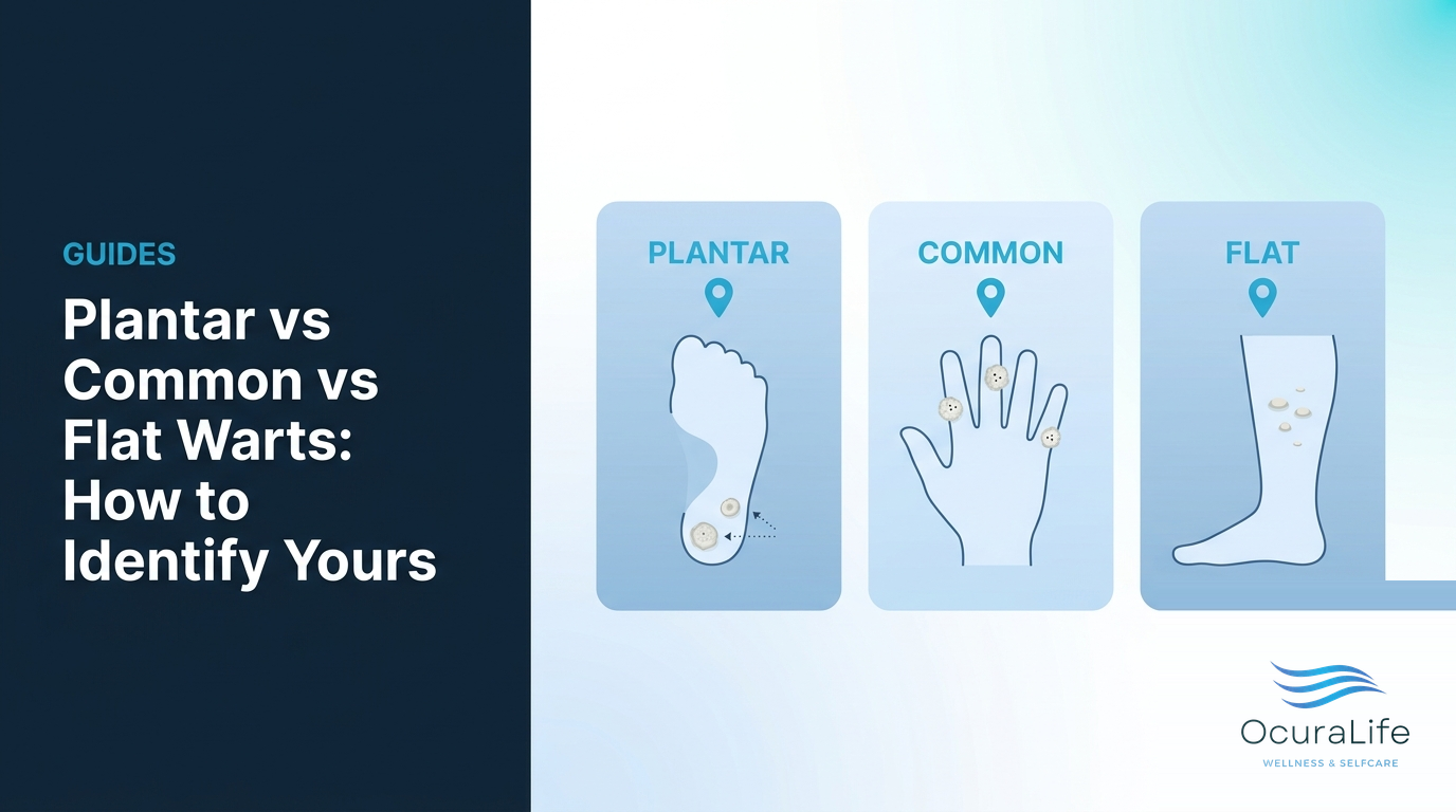 Plantar vs Common vs Flat Warts: How to Identify Yours - OcuraLife