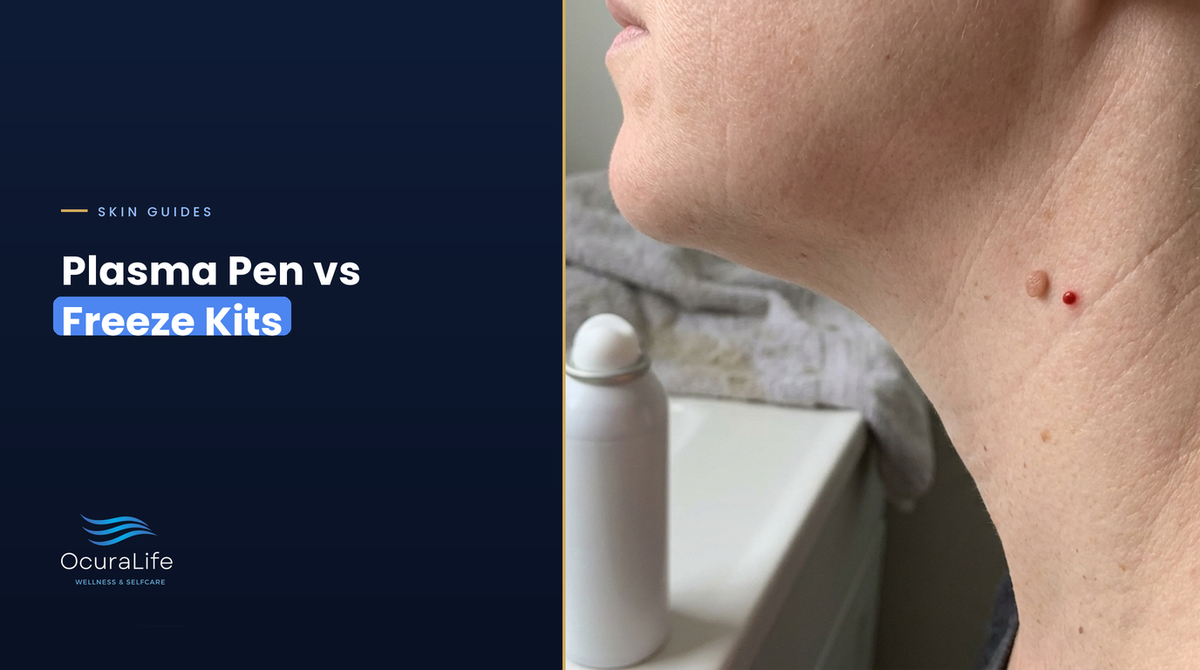 Plasma pen vs freeze kits: a small skin tag and a tiny red cherry angioma on a woman's neck beside a freeze spray can