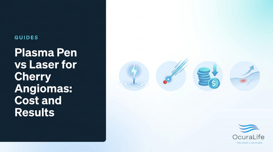 Plasma Pen vs Laser for Cherry Angiomas: Cost and Results