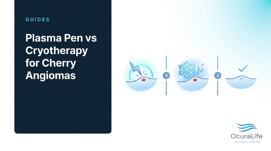 Plasma Pen vs Cryotherapy for Cherry Angiomas
