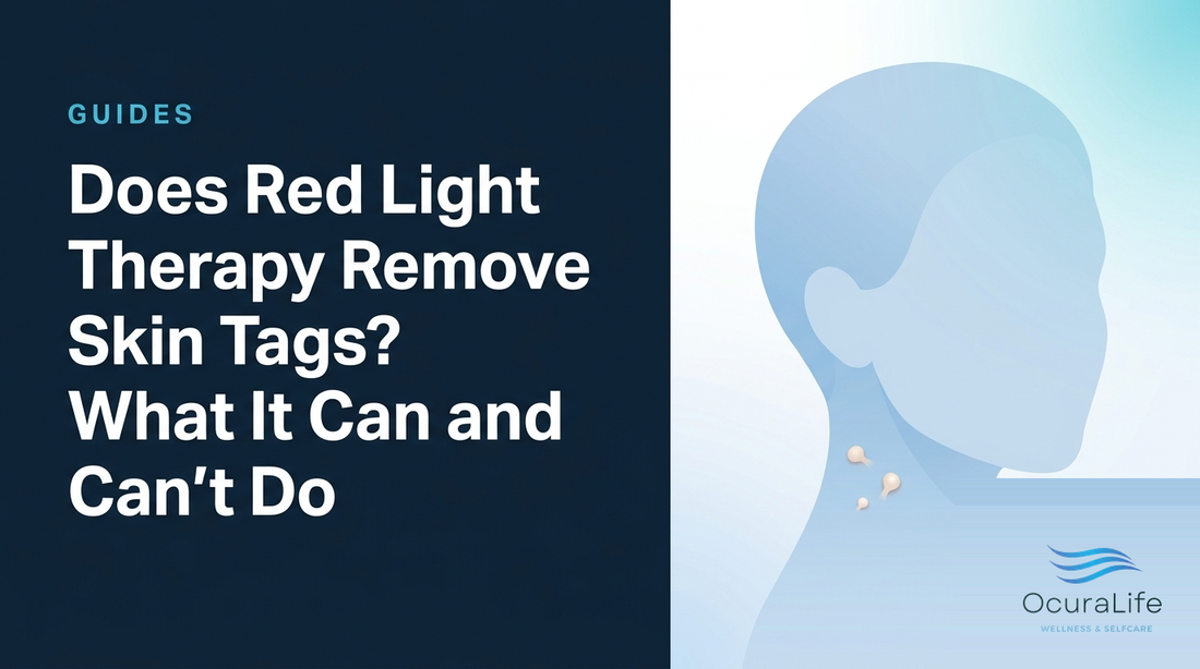 Does Red Light Therapy Remove Skin Tags? What It Can and Can't Do