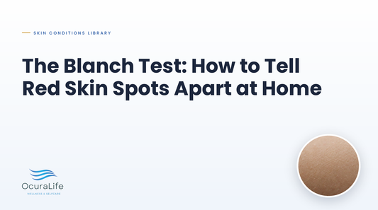 The Blanch Test: How to Tell Red Skin Spots Apart at Home