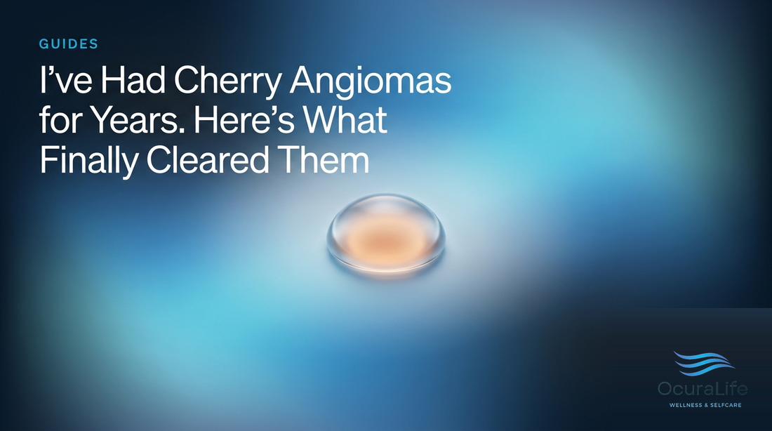 I've Had Cherry Angiomas for Years. Here's What Finally Cleared Them