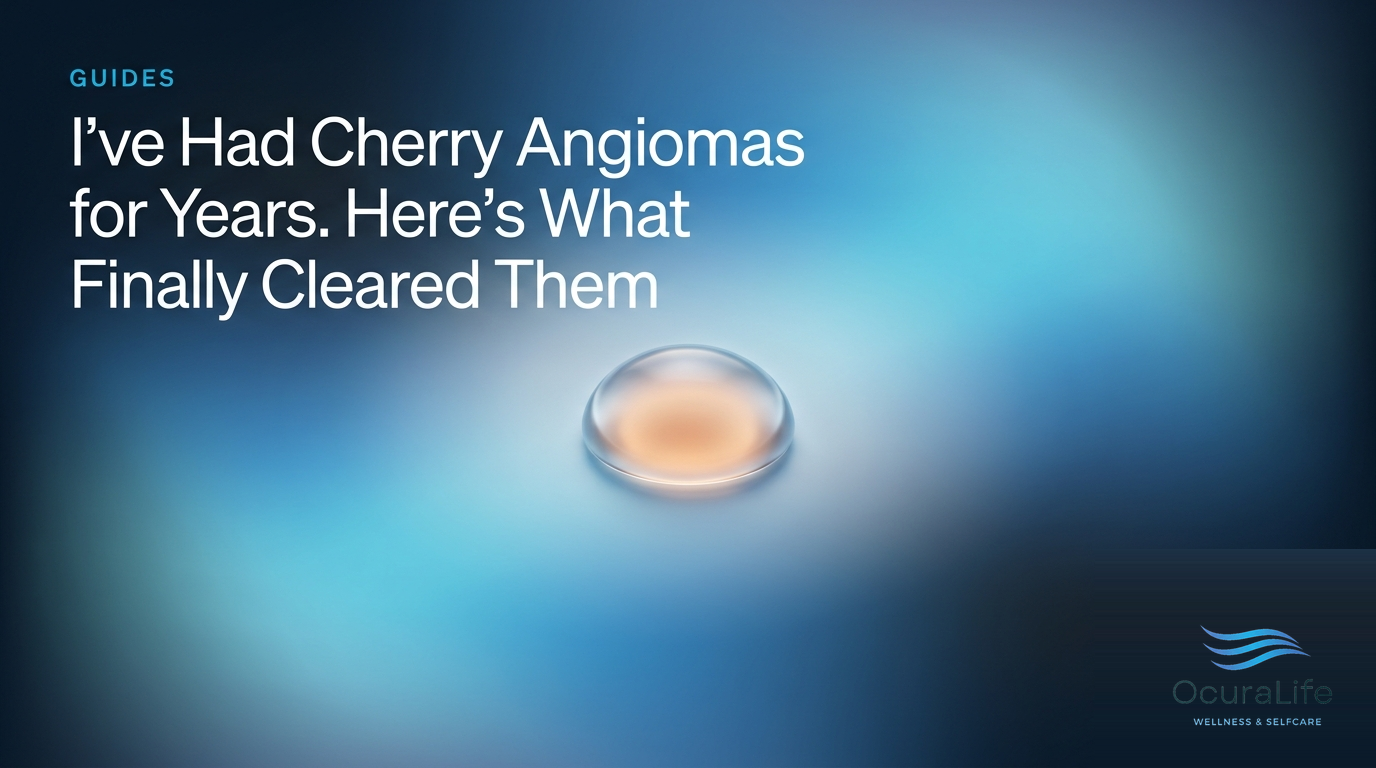 I've Had Cherry Angiomas for Years. Here's What Finally Cleared Them