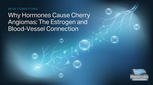 Why Hormones Cause Cherry Angiomas: The Estrogen and Blood-Vessel Connection