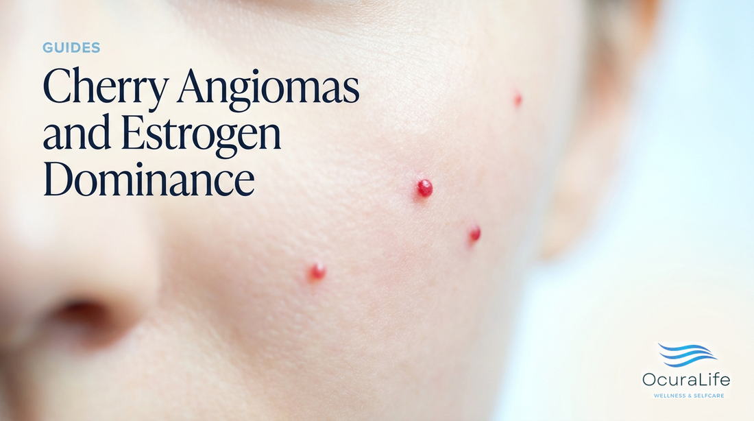 Cherry Angiomas and Estrogen Dominance
