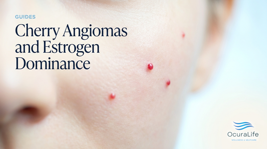Cherry Angiomas and Estrogen Dominance