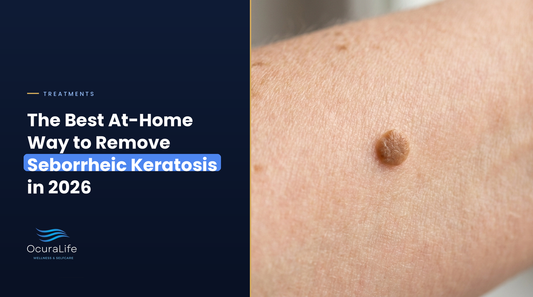 The Best At-Home Way to Remove Seborrheic Keratosis in 2026