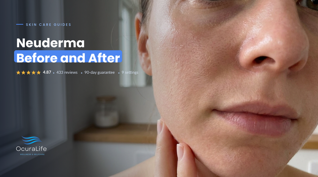 Neuderma Before and After: What to Realistically Expect