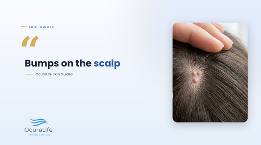 Spots and bumps on the scalp: what they are and how to treat them
