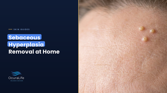 Small yellowish sebaceous hyperplasia bumps on the forehead of a woman in her fifties
