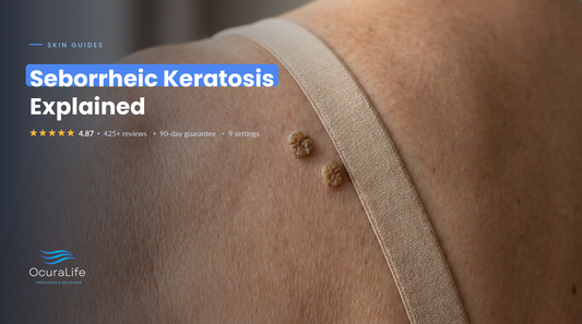 Seborrheic keratosis: raised waxy brown stuck-on growths on the upper back beside a bra strap