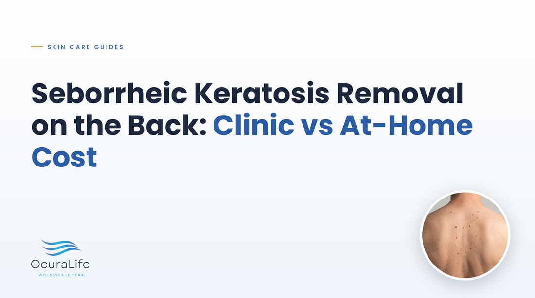 Seborrheic Keratosis Removal on the Back: Clinic vs At-Home Cost