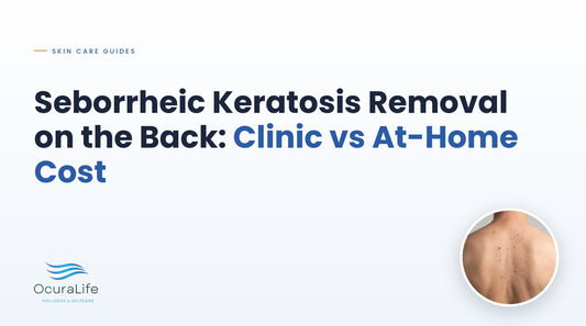 Seborrheic Keratosis Removal on the Back: Clinic vs At-Home Cost