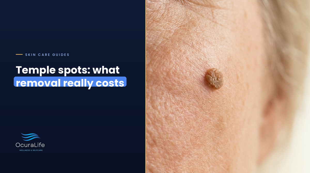 Seborrheic Keratosis Removal on the Temple: Clinic vs At-Home Cost