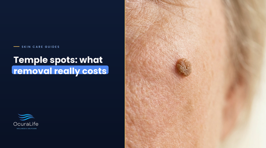 Seborrheic Keratosis Removal on the Temple: Clinic vs At-Home Cost