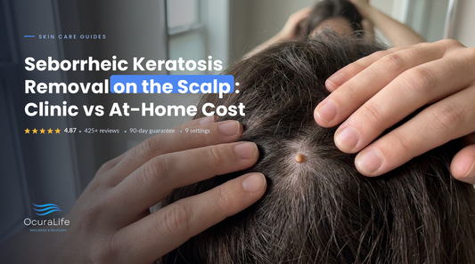 Seborrheic Keratosis Removal on the Scalp: Clinic vs At-Home Cost