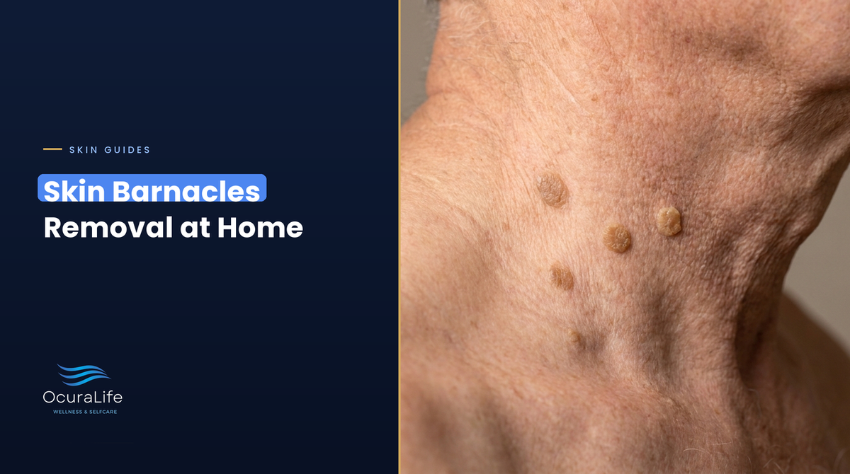 Skin barnacles (seborrheic keratoses) on the side of an older man's neck