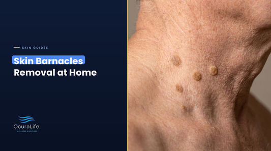 Skin barnacles (seborrheic keratoses) on the side of an older man's neck