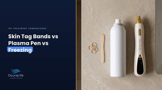 Skin Tag Bands vs Plasma Pen vs Freezing: What Actually Works