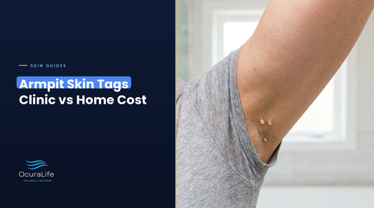 Small cluster of skin tags in the armpit fold of a raised arm