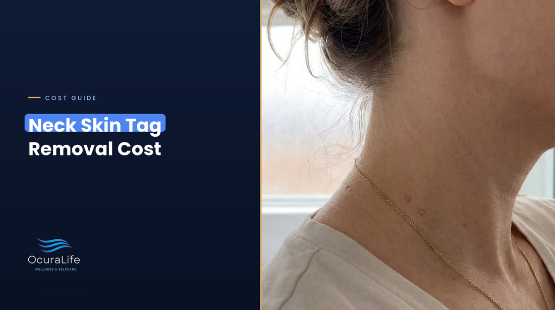 Small skin tags on the side of a woman's neck near a thin necklace, neck skin tag removal cost guide