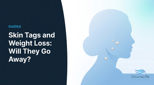 Skin Tags and Weight Loss: Will They Go Away? - OcuraLife