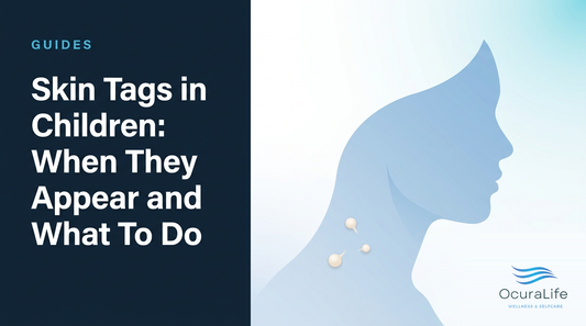 Skin Tags in Children: When They Appear and What To Do - OcuraLife