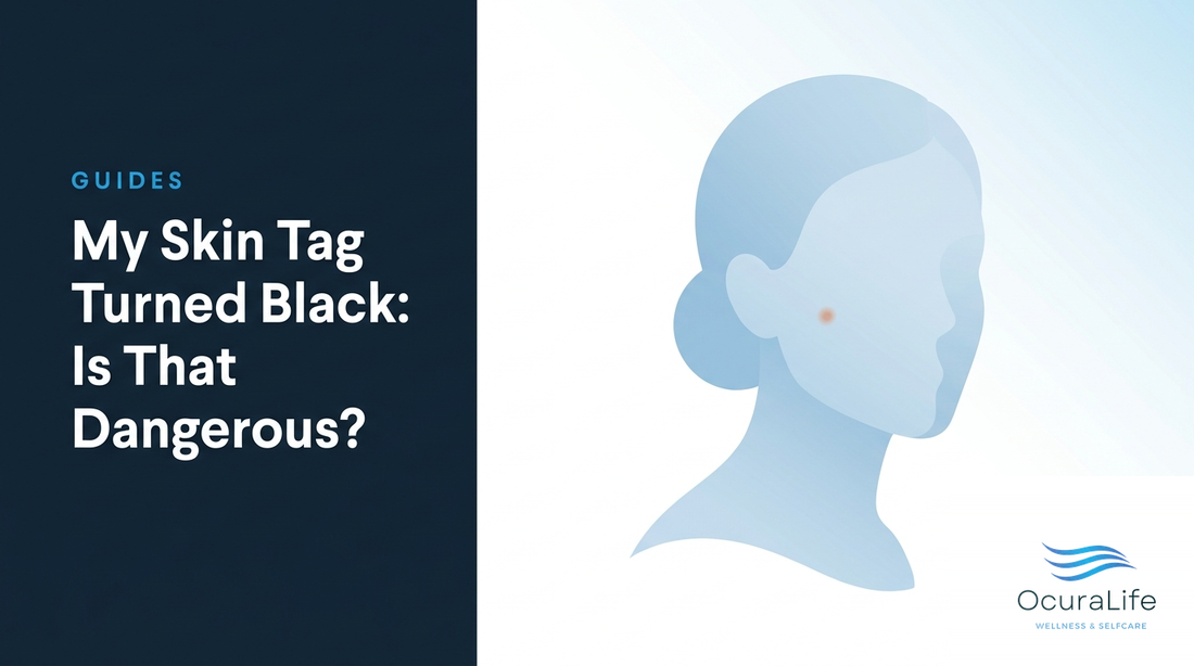 My Skin Tag Turned Black: Is That Dangerous?