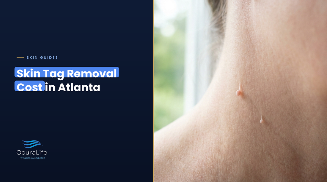 Skin tag removal cost in Atlanta: two small flesh-colored skin tags on the side of a woman's neck