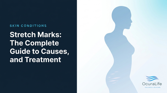 Editorial illustration: Stretch Marks: The Complete Guide to Causes, Types, and Treatment