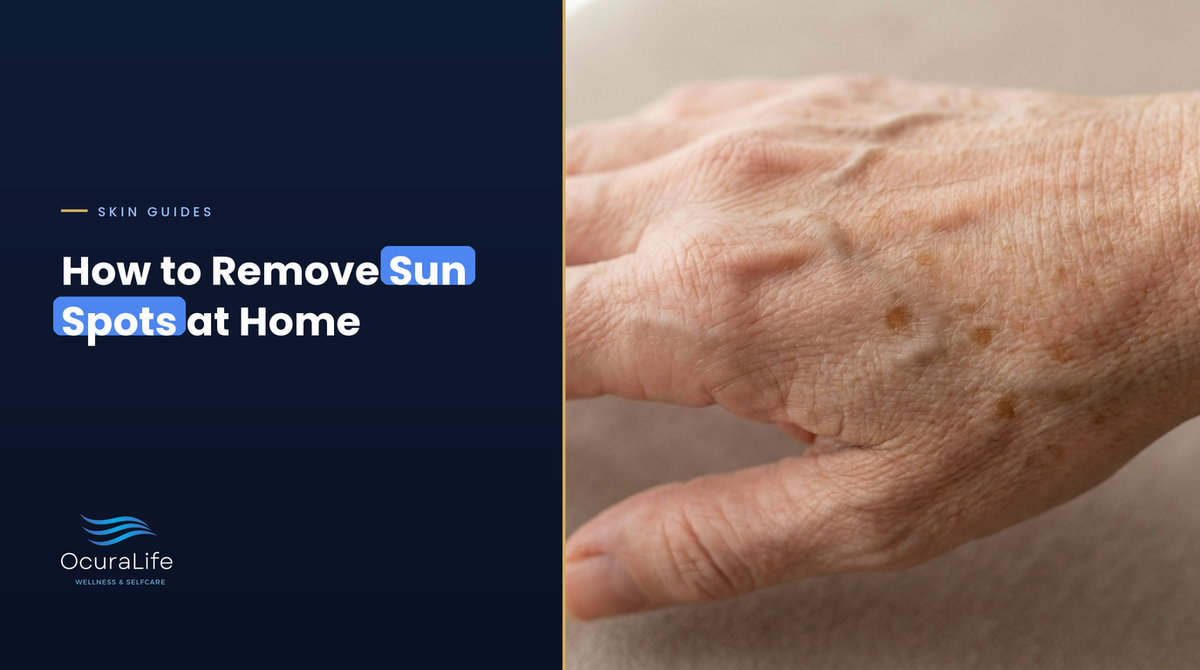 Back of a mature hand with flat tan-brown sun spots, cover for how to remove sun spots at home