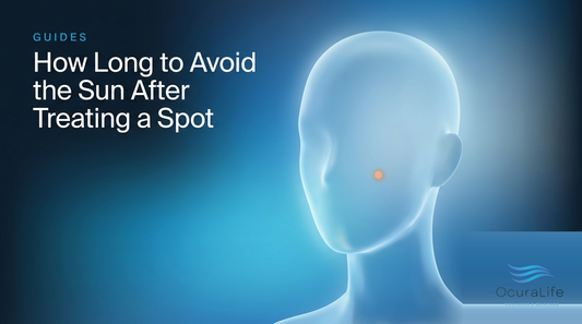 How Long to Avoid the Sun After Treating a Spot
