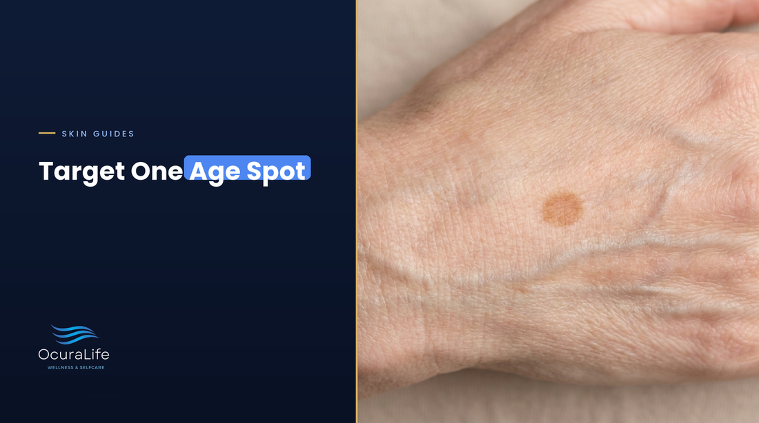 A single flat brown age spot on the back of a hand, the kind you can target on its own