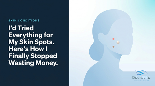 Editorial illustration: I'd Tried Everything for My Skin Spots. Here's How I Finally Stopped Wasting Money.