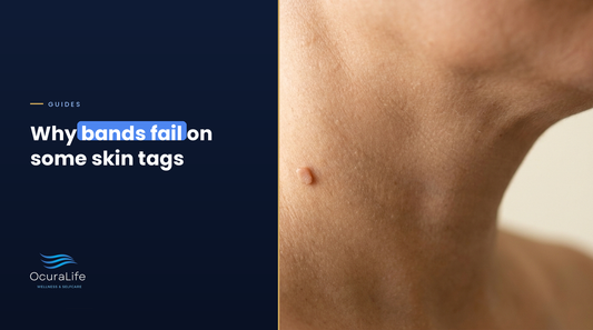 Vora Not Working? Why Bands Fail on Some Tags and What to Do