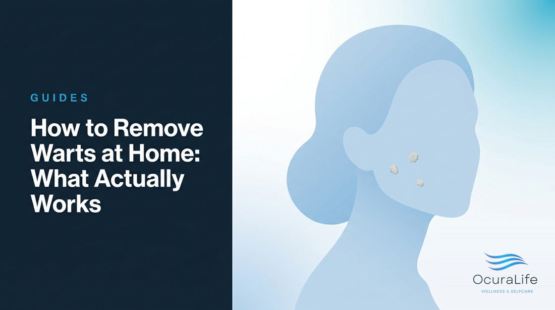 How to Remove Warts at Home: What Actually Works - OcuraLife