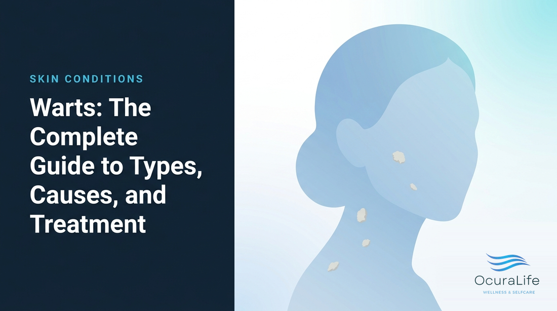Warts: The Complete Guide to Types, Causes, and Treatment - OcuraLife