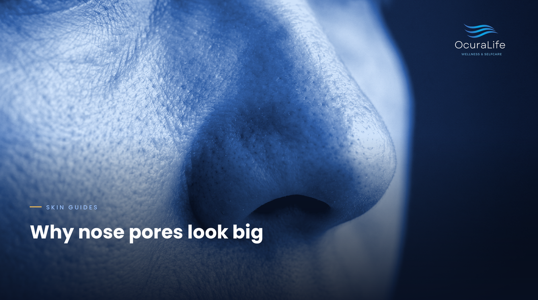 What Causes Large Pores on the Nose and Cheeks?