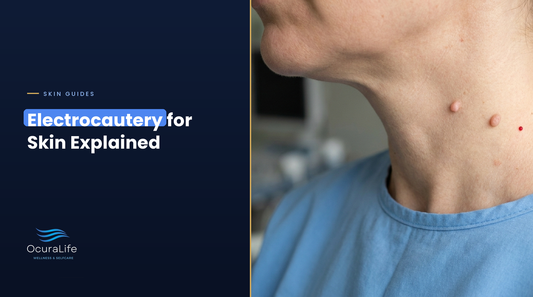Two small skin tags and a tiny red cherry angioma on the side of a woman's neck, the kind of growths electrocautery removes