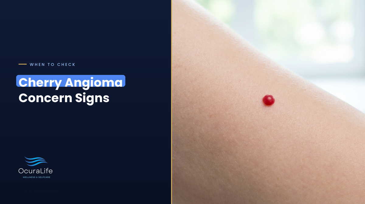 A small red cherry angioma on the upper arm, and the signs that mean it is worth a doctor's look