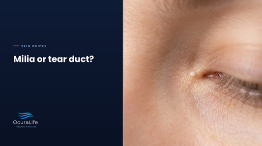 White Bump Under the Eye: Milia or Something Else?